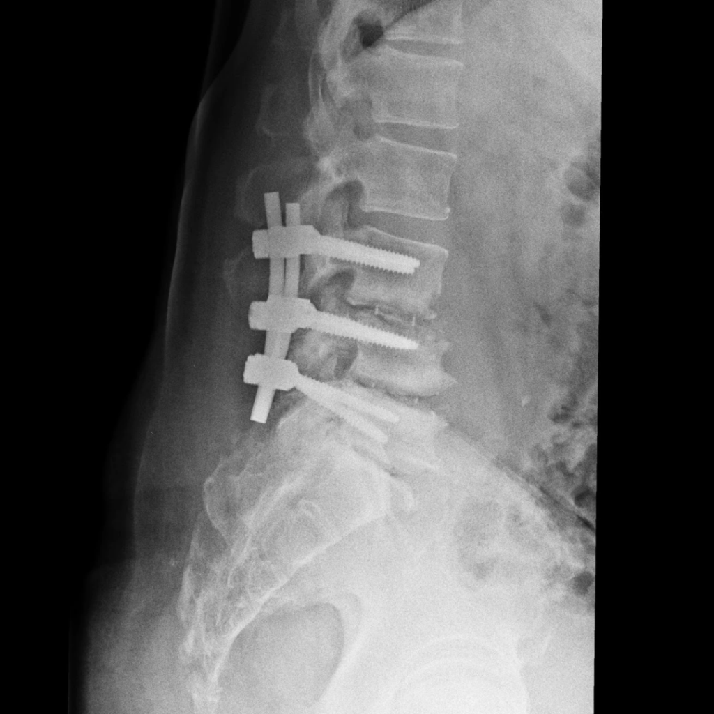 SPINE image