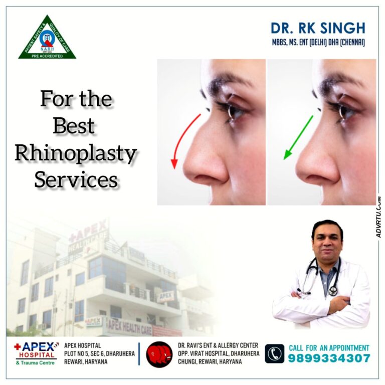 Rhinoplasty
